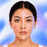 SS ‑ AI Skin Analysis logo